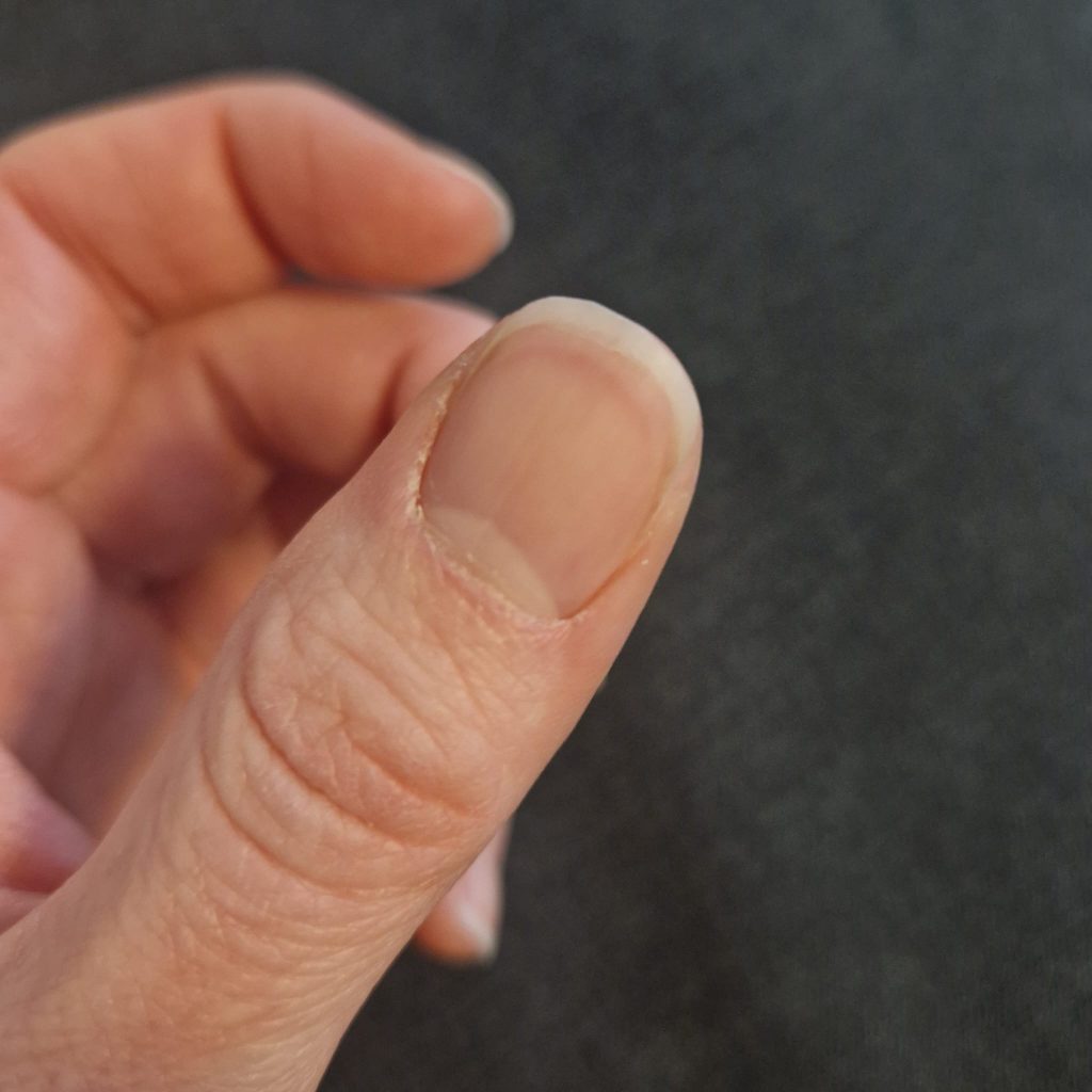 Nail after using the nail clipper